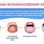 how to get rid of snoring during sleep reasons