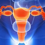 как лечат полипы эндометрия