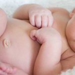 How to treat an umbilical wound?