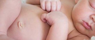 How to treat an umbilical wound?