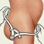 Как определить узкий ли таз для родов