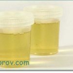 Как понять, что ты беременна в домашних условиях