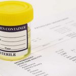 Как собрать анализ мочи по нечипоренко, расшифровка показателей у детей