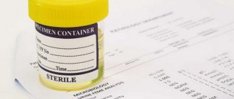 Как собрать анализ мочи по нечипоренко, расшифровка показателей у детей