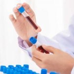 What tumor markers should women take for prevention?