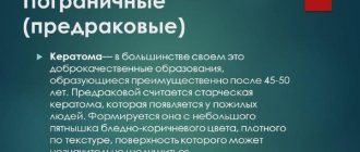 Кератома кожи - симптомы и лечение у взрослых, фото на лице, голове. Себорейная, старческая, сенильная