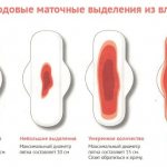 Caesarean section: pros and cons for baby and mother. Indications, consequences, recovery. Advice and opinions from experts 
