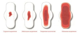 Кесарево сечение: плюсы и минусы для ребенка и мамы. Показания, последствия, восстановление. Советы и мнения специалистов