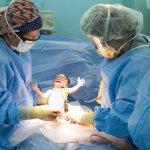 Кесарево сечение