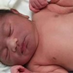 Клиническая картина