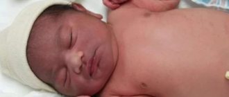 Клиническая картина