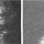 Когда можно узнать пол ребенка на УЗИ