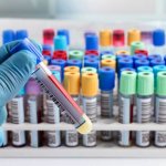 When is a biochemical blood test prescribed?