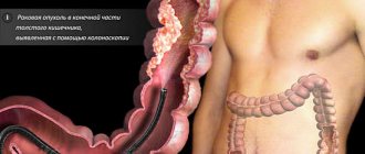 colonoscopy preparation