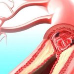 Кровеносный сосуд в разрезе