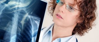 Croupous pneumonia