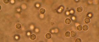 Leukocytes in a child's urine