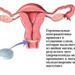 Линдинет 20 инструкция по применению