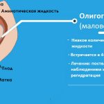 маловодие, рисунок