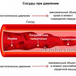 Механизм развития ГБ 1 степени