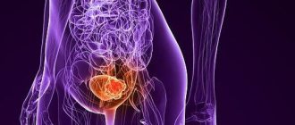 Мочевой пузырь