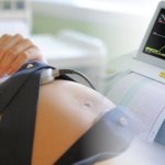 Is it possible to determine the approach of labor using a CTG || Is it possible to determine the approach of labor using a CTG? 