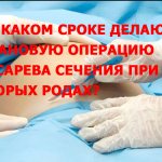 at what stage is a planned caesarean section performed during the second birth?