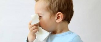 Runny nose in a child