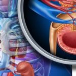 Nephroblastoma: a favorable prognosis is real