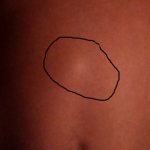 Общая информация о болезни