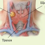 Около пяти процентов населения планеты страдают от единичных или множественных узловых образований на щитовидке