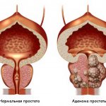 они проявляются по разному и зависят от стадии заболевания