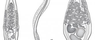 Opisthorchiasis is a disease caused by flatworms of the fluke class, most often caused by liver flukes, cat flukes and Siberian flukes.
