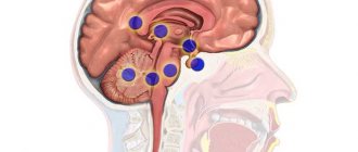 a brain tumor