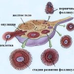 особенность процедуры