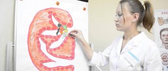 Acute glomerulonephritis