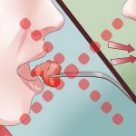 отрыжка воздухом