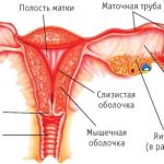 Перевязка труб у женщин. Последствия для здоровья, побочные эффекты