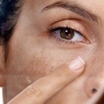 Пигментные пятна при беременности на лице, животе, груди и теле: почему возникают, как избавиться?