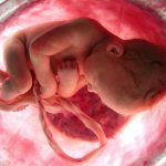 Плод и плацента в утробе