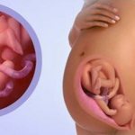 Плод на 36 неделе беременности