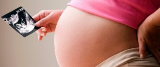 Плохо шевелится ребенок на 38 неделе