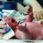 Pneumonia due to ingress of amniotic fluid