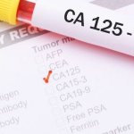 Why is tumor marker CA-125 elevated?