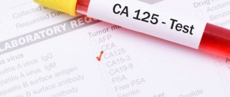 Why is tumor marker CA-125 elevated?
