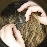 Поговорим о правильном и эффективном лечении от вшей и гнид на голове