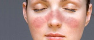 Показания к скрининговой диагностике