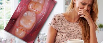 Let's try to figure out what a pregnant woman should do when a toothache occurs - should she immediately call the dentist or can she somehow endure the problem, using, for example, painkillers...