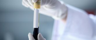 повышение фсг и лг в мц