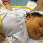 Пожелтение кожи на 3-4 день жизни - признак поражении вирусом у новорожденных